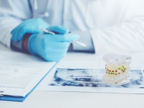 Model stomatologiczny szczęka zęby zębów aparat ortodontyczny