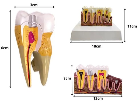 Model anatomiczny zęba stomatologiczny edukacyjny przekrój wyjmowany ząb